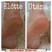 /album/boszipedikur/a2015-02-18-1-jpg1/